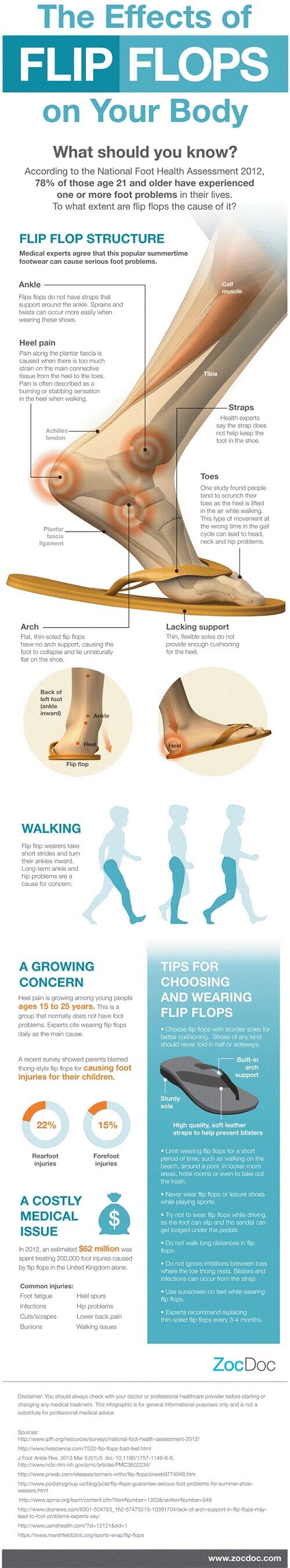 Qué efecto tiene usar chanclas por mucho tiempo #infografia